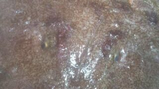 アンコウの季節です!アンコウは卵が旨い!